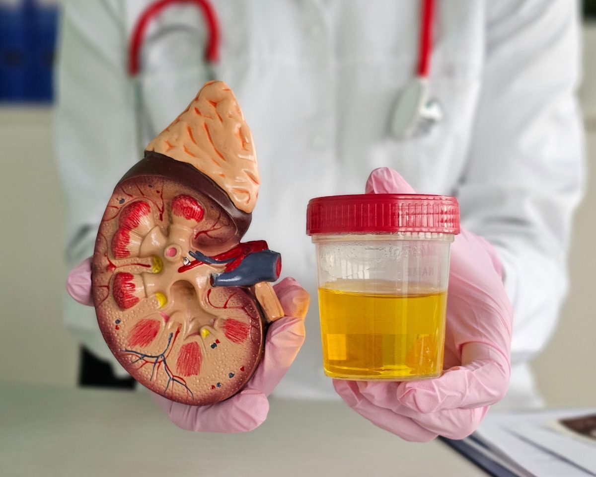 Predicting chronic kidney disease progression